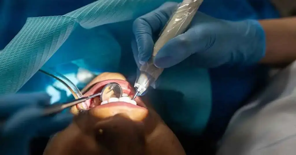 How is root canal treaments