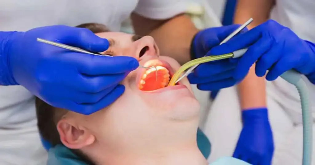 What is root canal