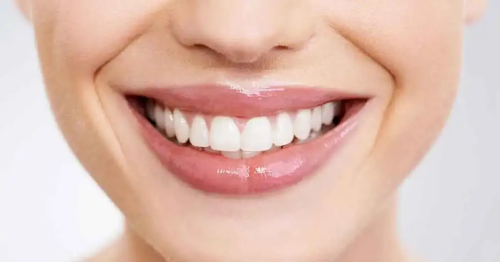 Hollywood Smile Turkey