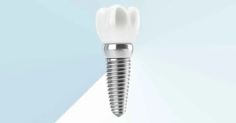 BEGO Dental implants