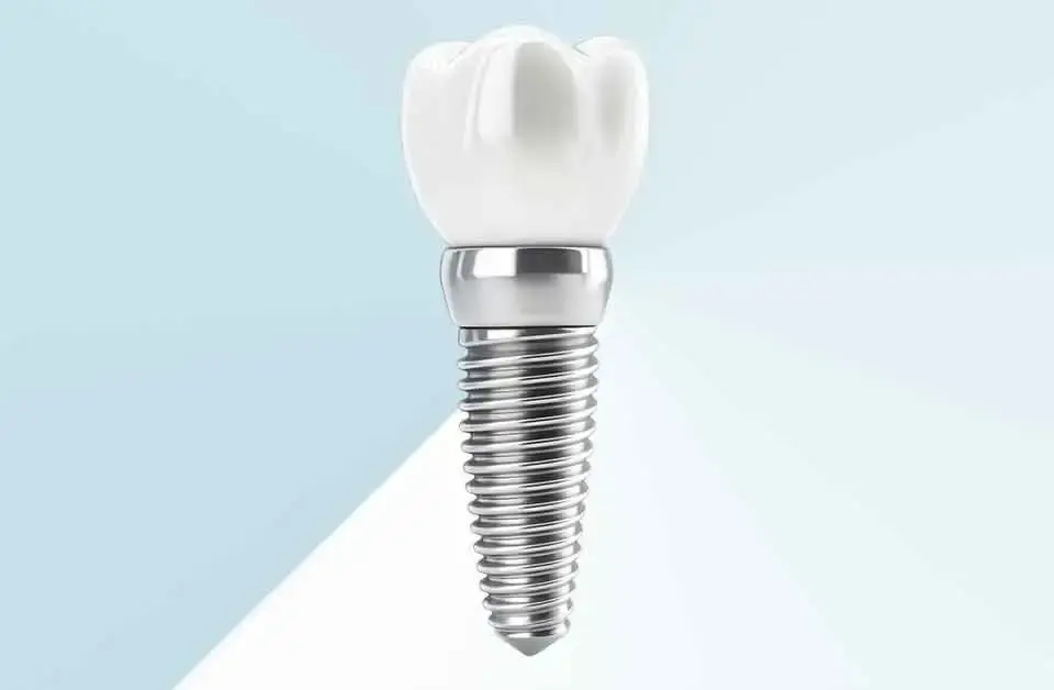BEGO Dental implants