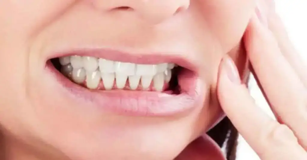 Teeth Grinding treament