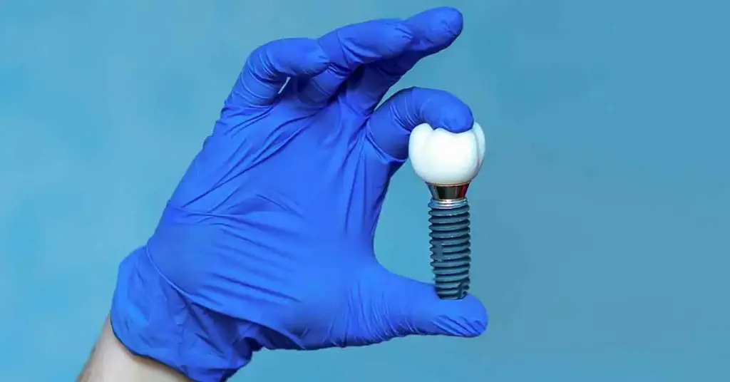 implant brands