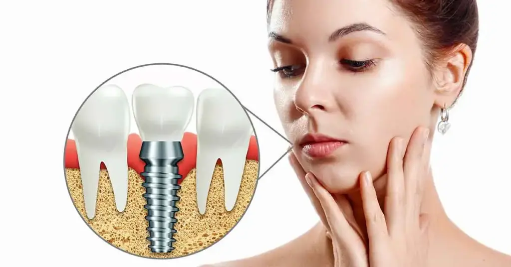 dental implant treatment