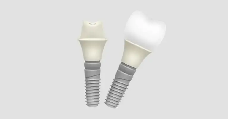 Dentsply Sirona Dental Implants