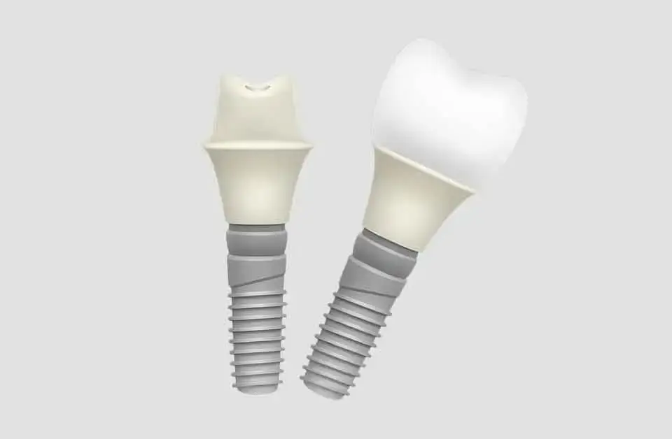 Dentsply Sirona Dental Implants