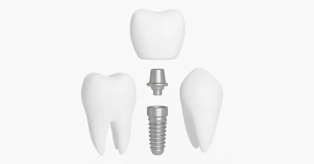 Hiossen Dental Implant