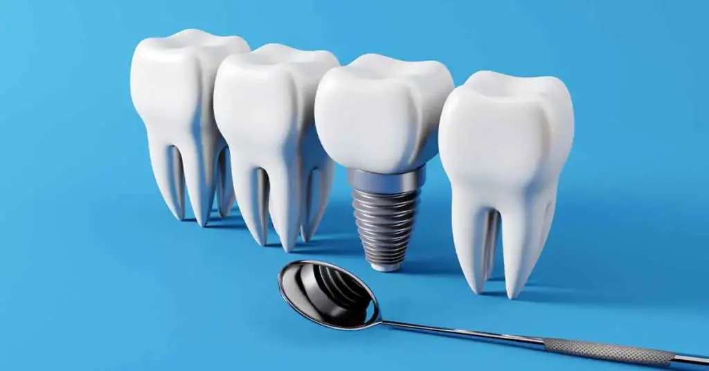 implant treatment process