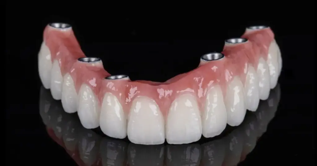 Immediate prosthesis process