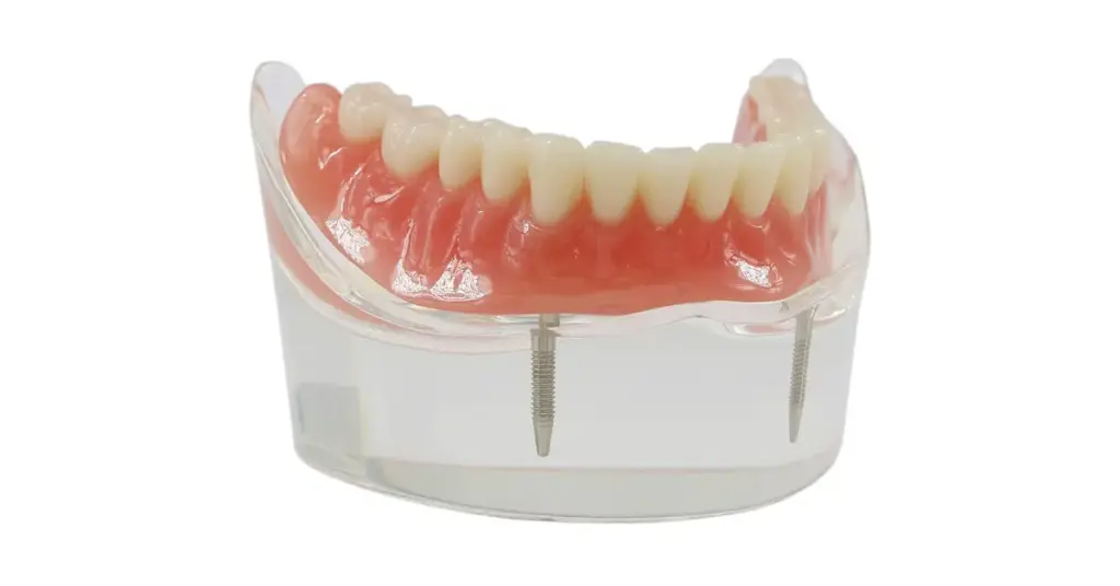 Risks of immediate dentures