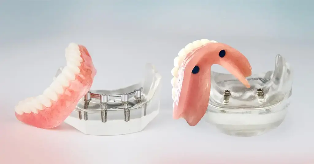 Immediate prosthesis