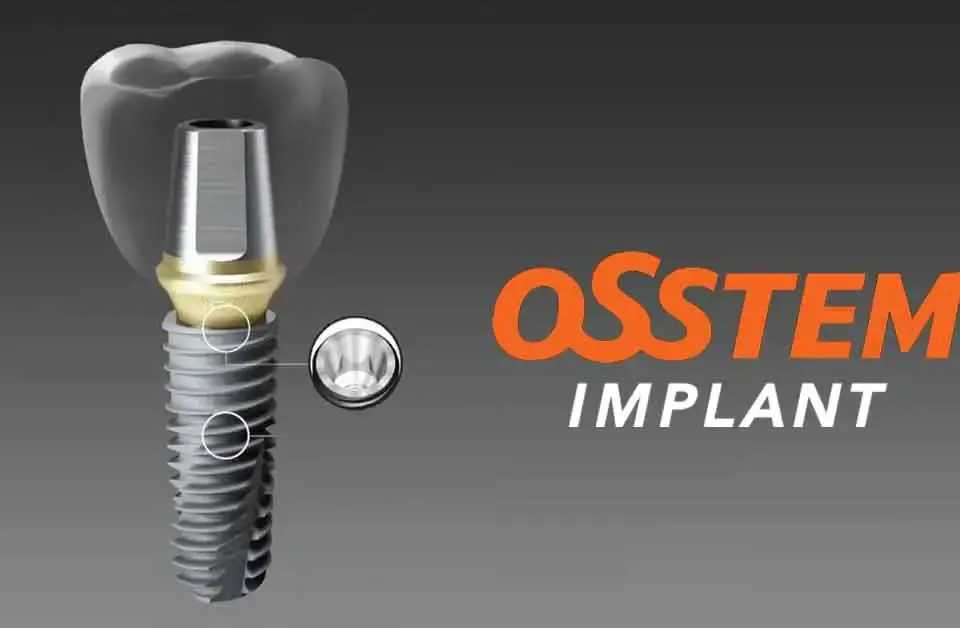 Osstem Dental Implants