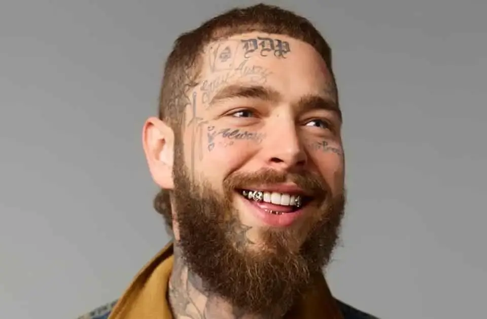 Post Malone's Teeth 2025
