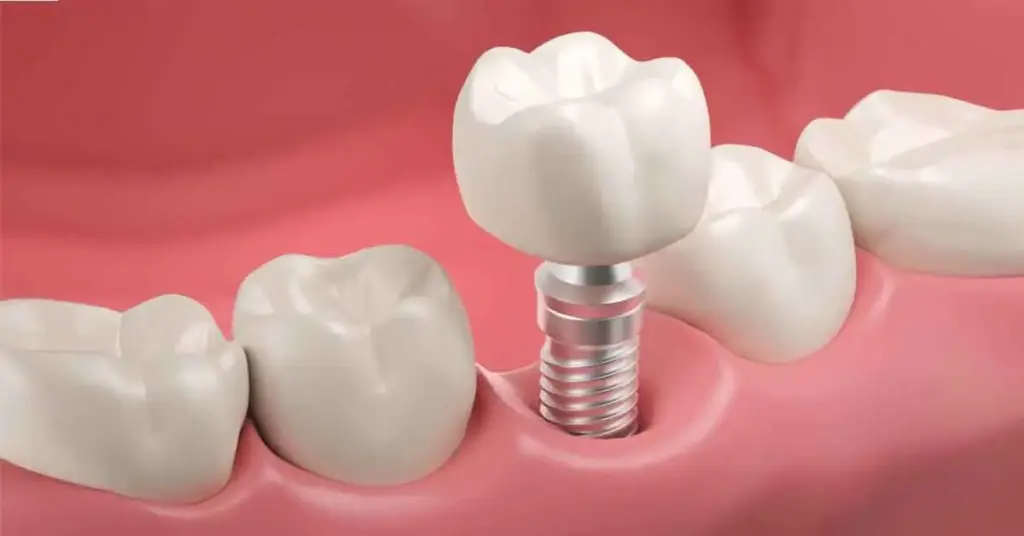 Комната Biomet