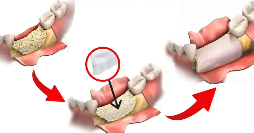Jawbone-Powder-production-stage