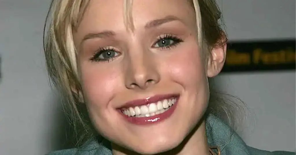 Kristen-Bell's-teeth-2000s
