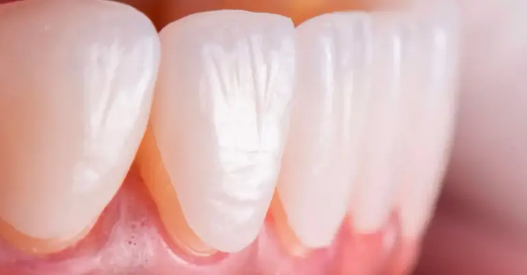 Уход за фарфоровым ламинатом