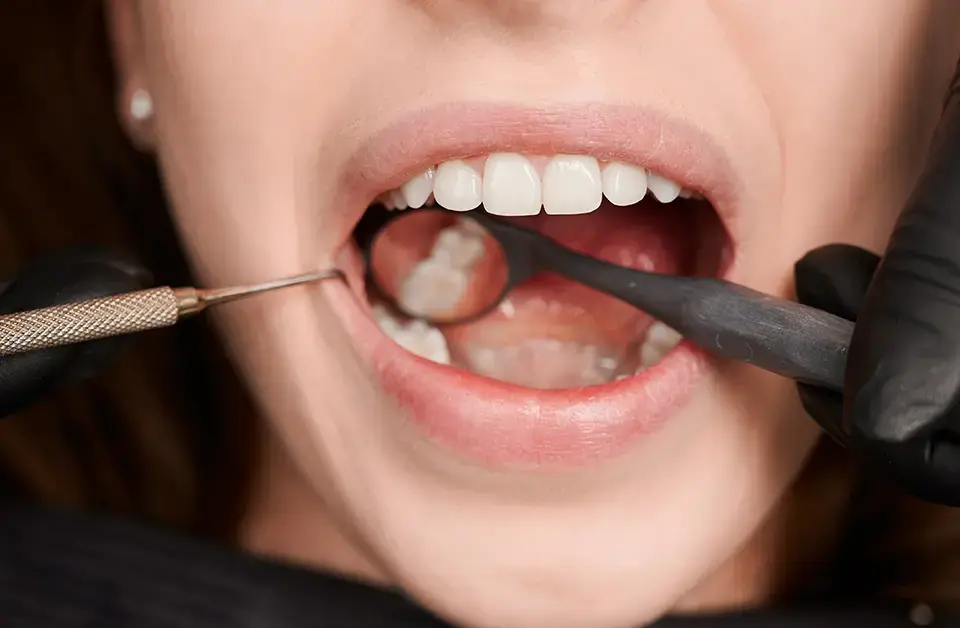 Revision Root Canal Treatment