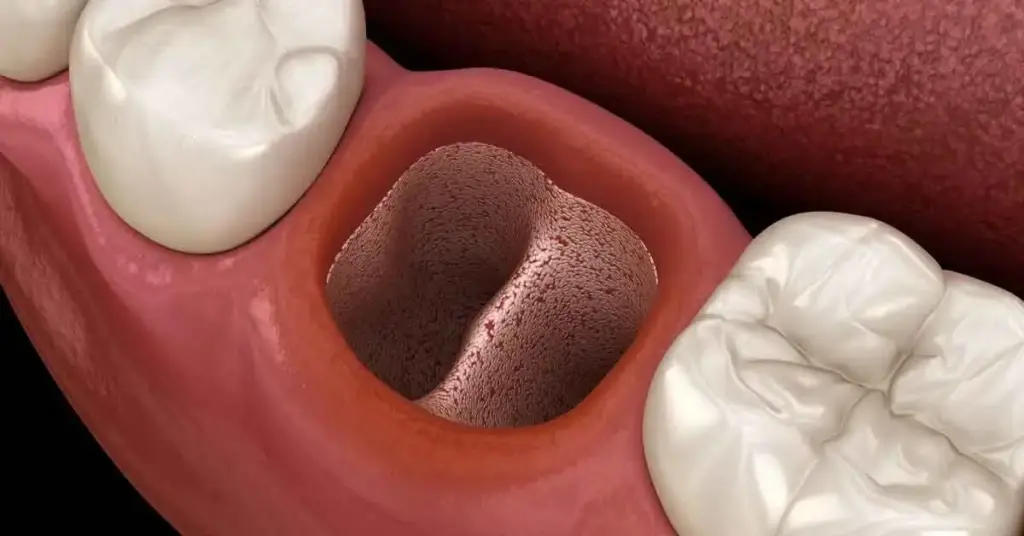 how use jawbone power and PRF