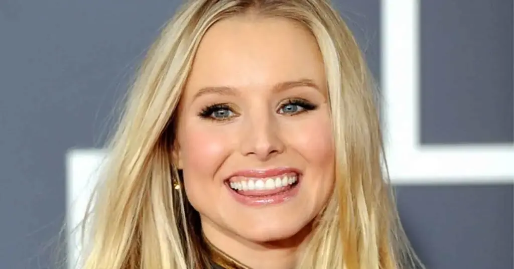 kristen-bell's-teeth-2010s