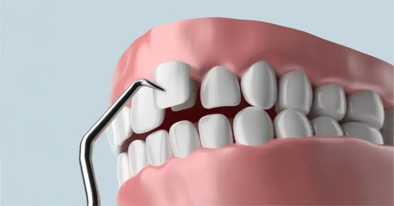 Срок службы шпона