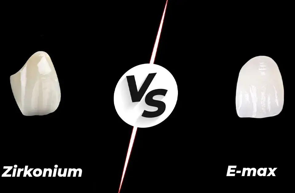 الزركونيوم أم Emax