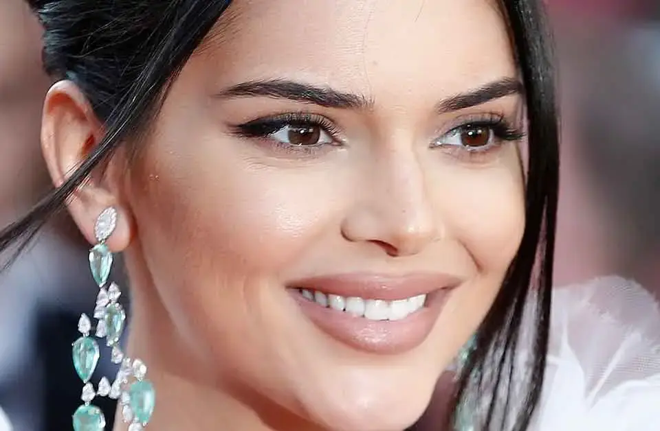 Kendall Jenner’s Teeth