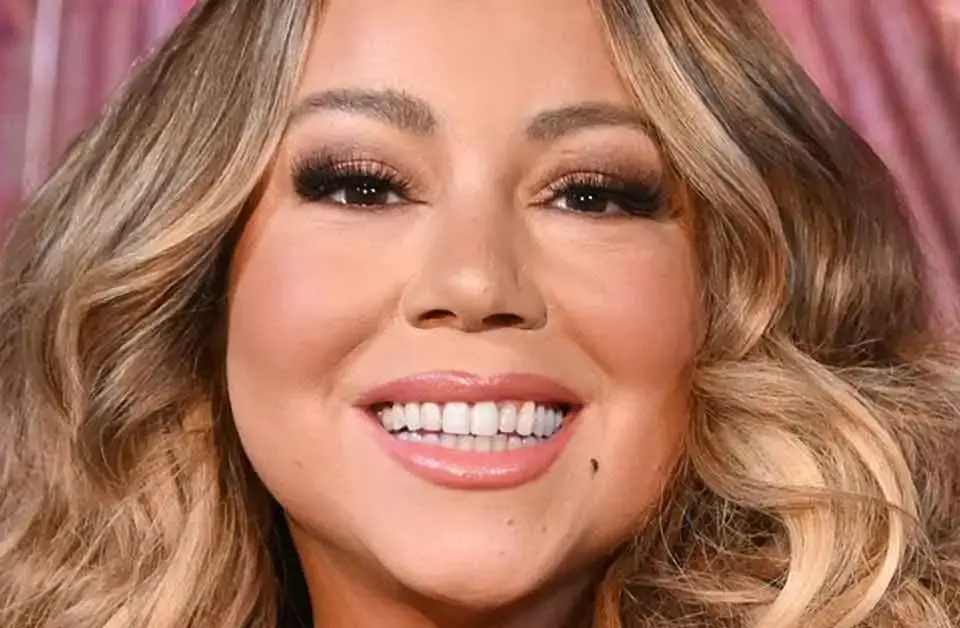 mariah careys teeth