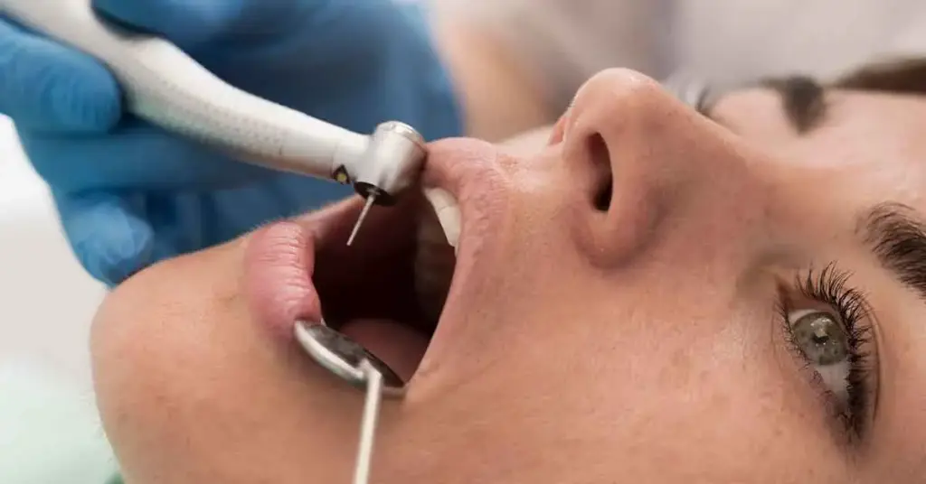 root canal treatment