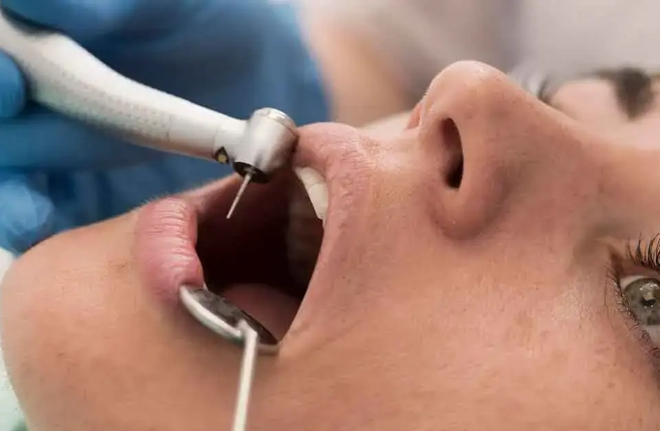 лечение корневых каналов