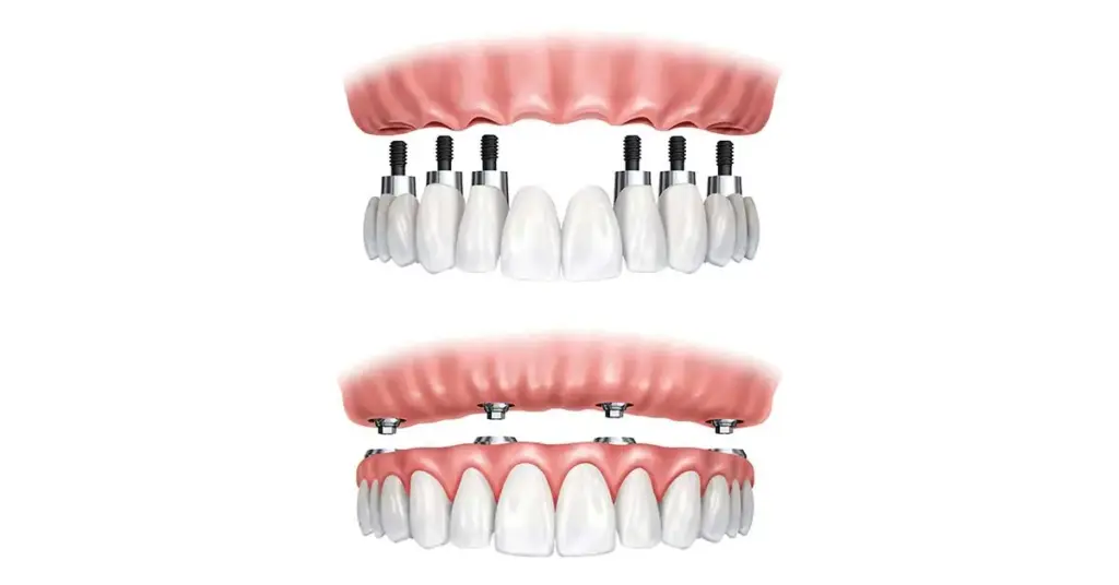 SMILE ALL ON FOUR/ SIX