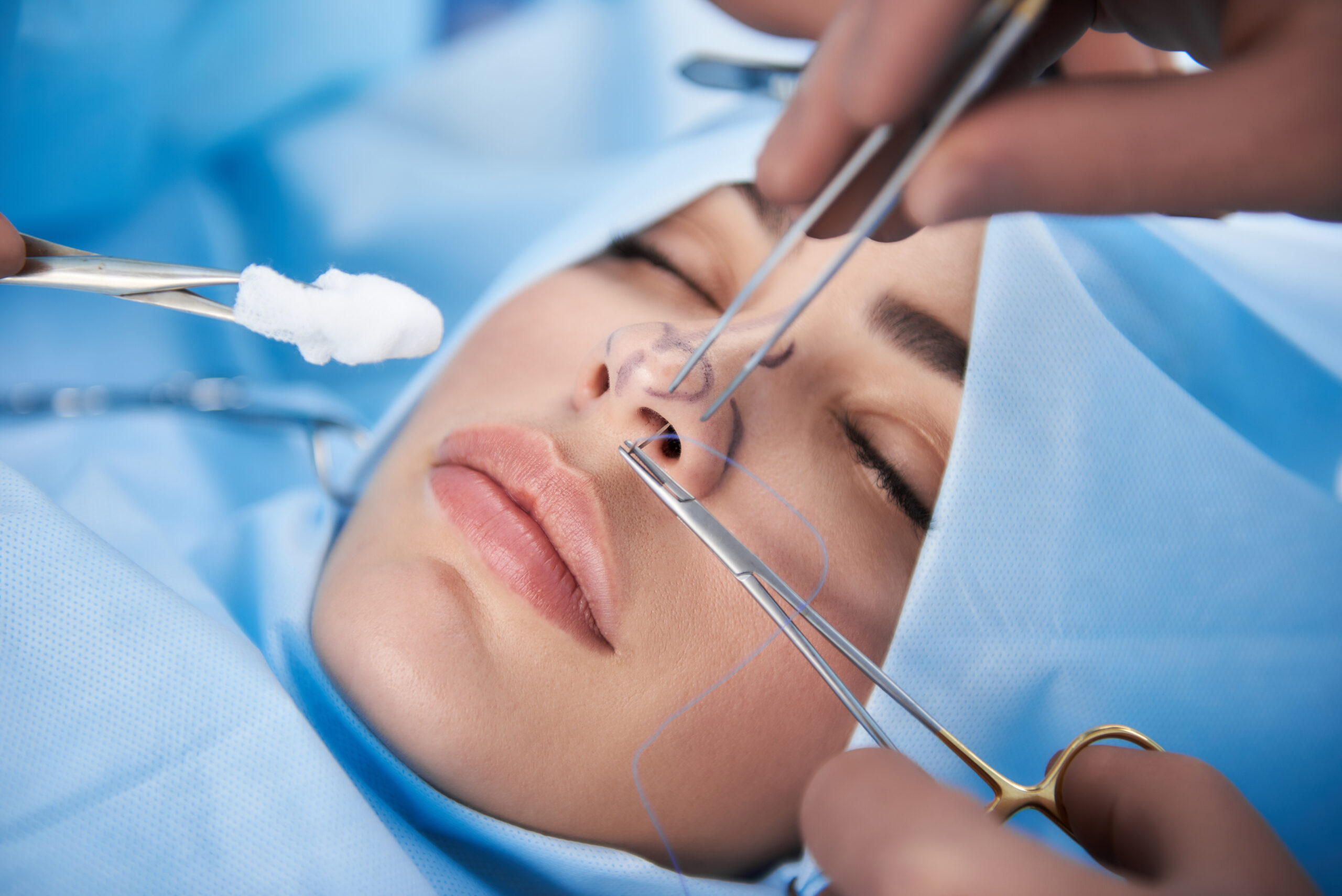Nose Surgery