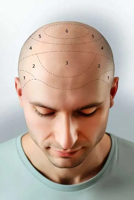 Selected zones preview