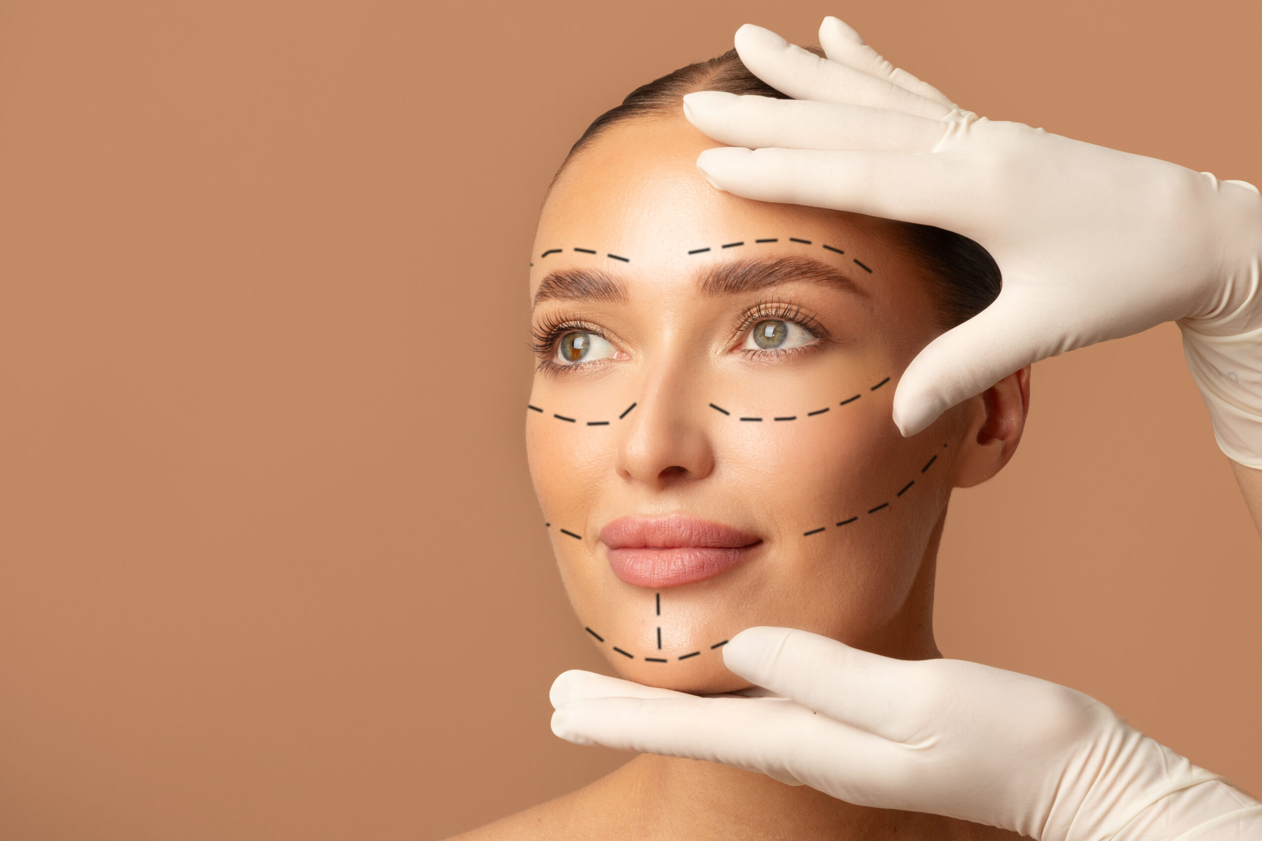 Facelift