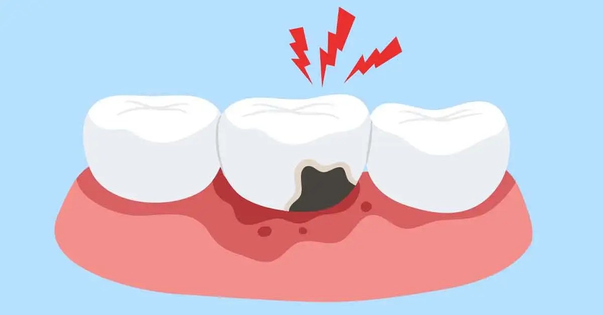 Dentist discussing treatment options for sensitive teeth with a patient