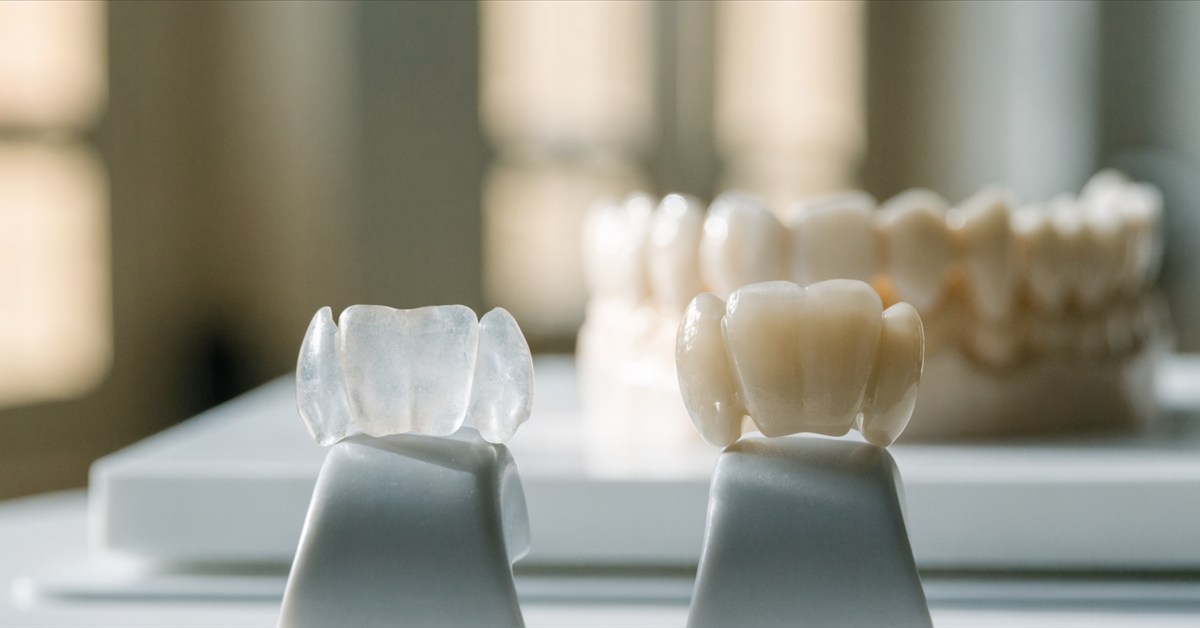 Thin E-max-style veneer and full zirconia crown shown side by side for dental treatment comparison