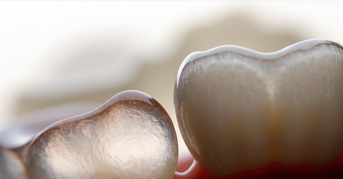 Lithium-disilicate veneer and zirconia crown samples showing different translucency and opacity