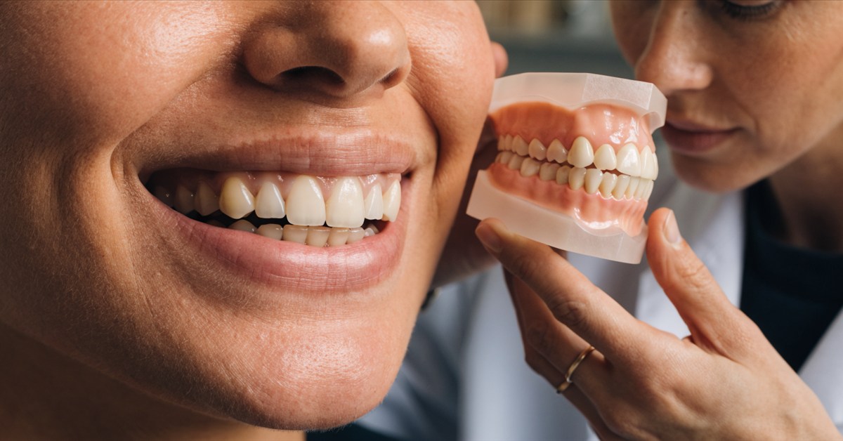 Mixed Hollywood Smile plan combining natural teeth and selected restorations