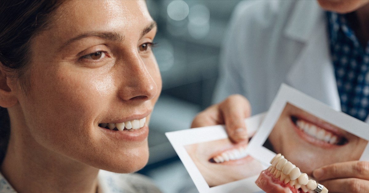 Natural veneer design based on smile width, tooth proportions and facial harmony