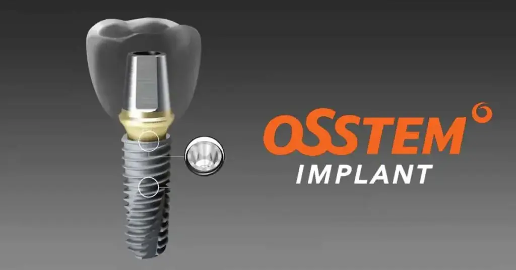 Osstem dental implant consultation at Niva Aesthetic