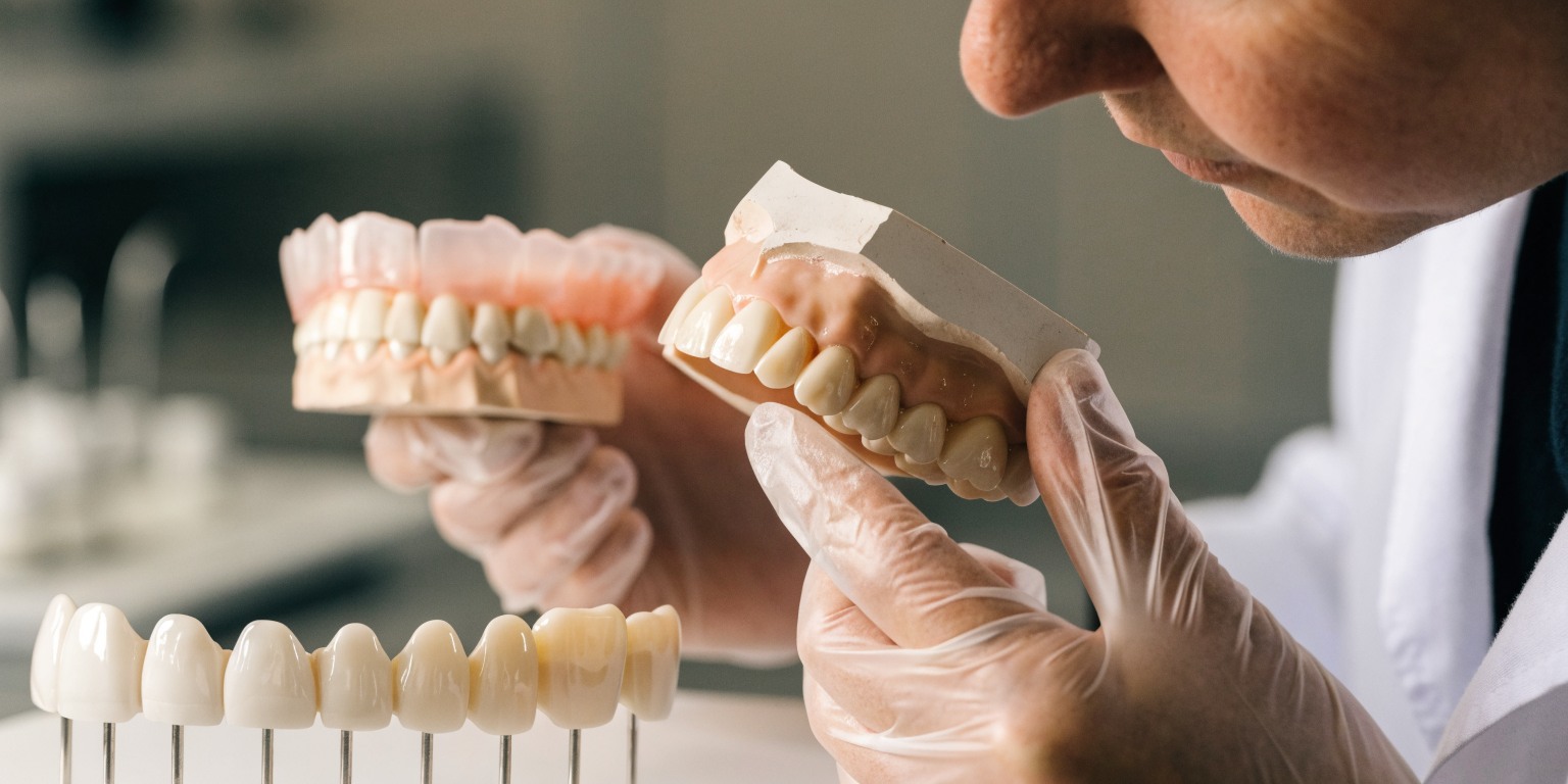 Temporary restorations and dental laboratory work during Hollywood Smile treatment
