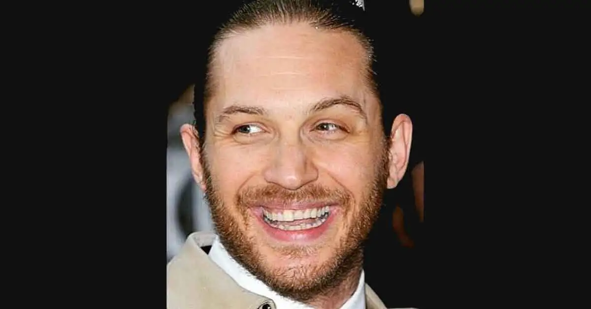 Les dents de Tom Hardy
