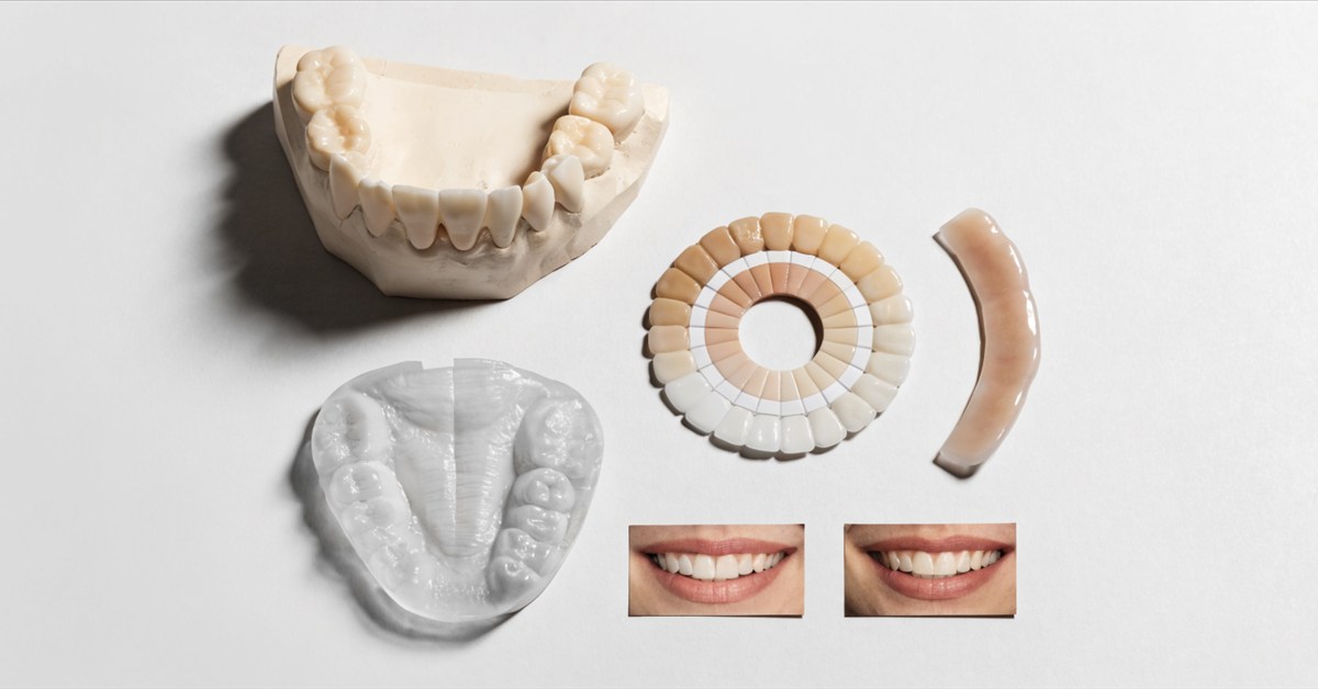 Clinical planning materials used to decide whether no-prep or minimal tooth preparation is appropriate