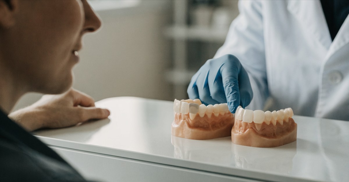 Dentist comparing conservative veneer coverage with full crown coverage on dental models