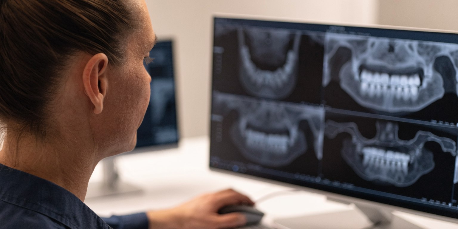 Dentist assessing upper-jaw bone and sinus anatomy on a CBCT scan