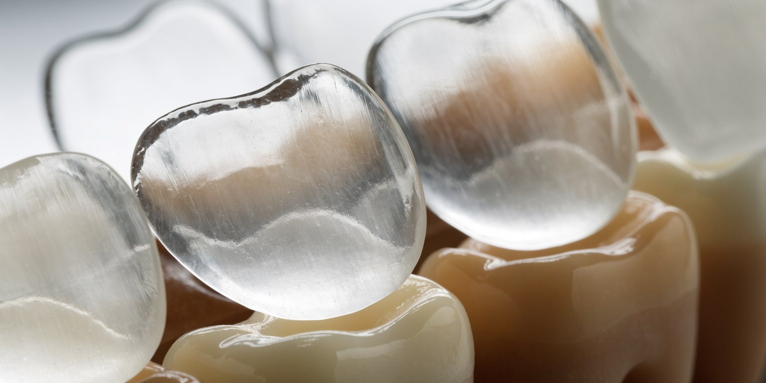 Thin ceramic veneers placed over different tooth-colored substrates to illustrate translucency and masking