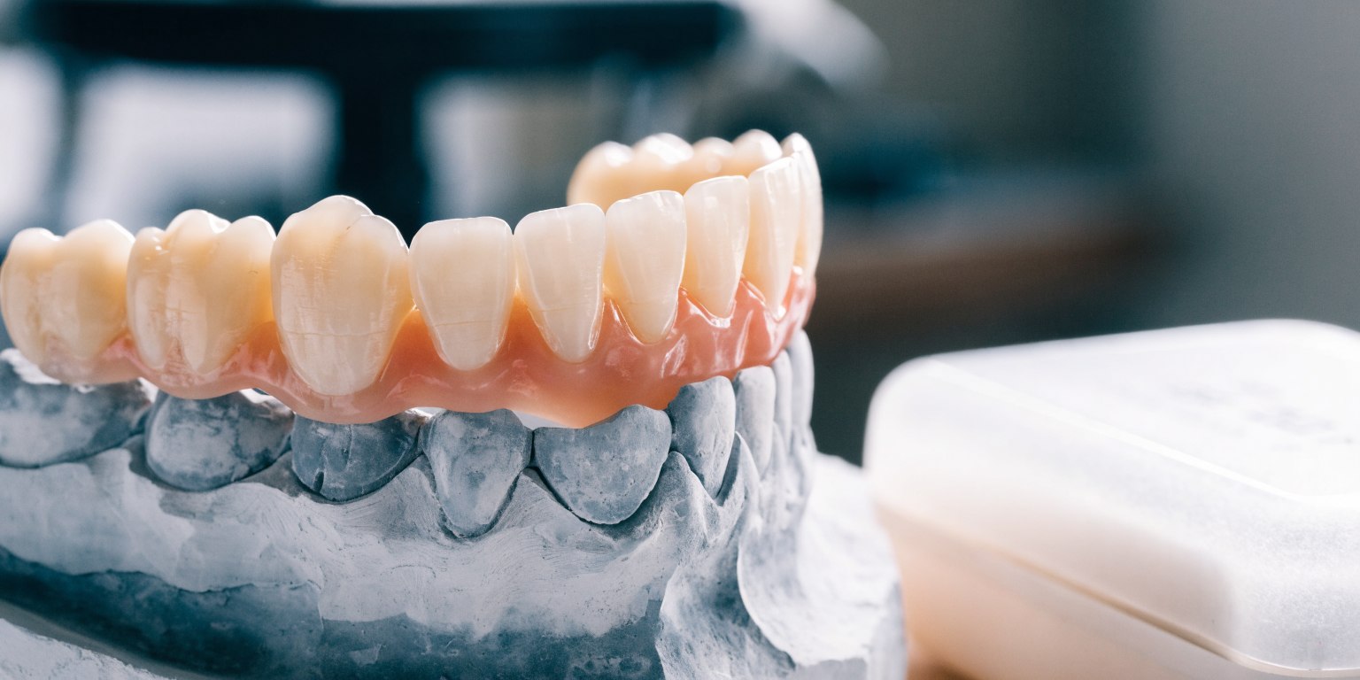Full-arch dental bridge resting on a model in a dental laboratory