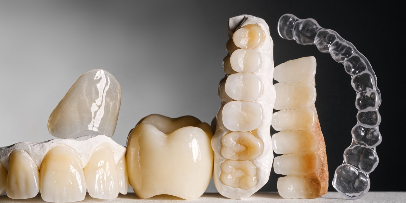 Different Hollywood Smile treatment components with different longevity and maintenance needs