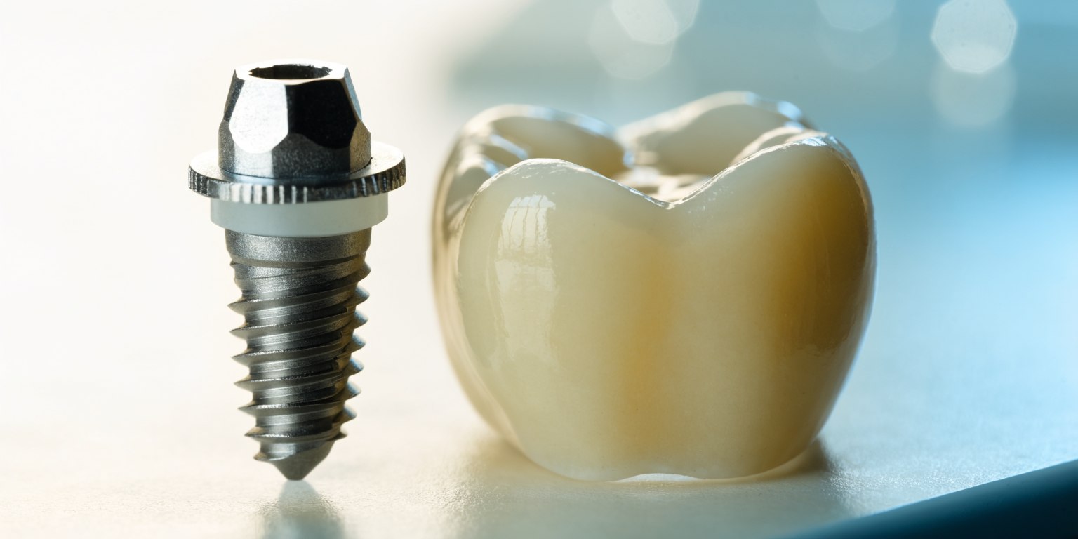 Dental teaching model showing an implant and its separate replacement crown