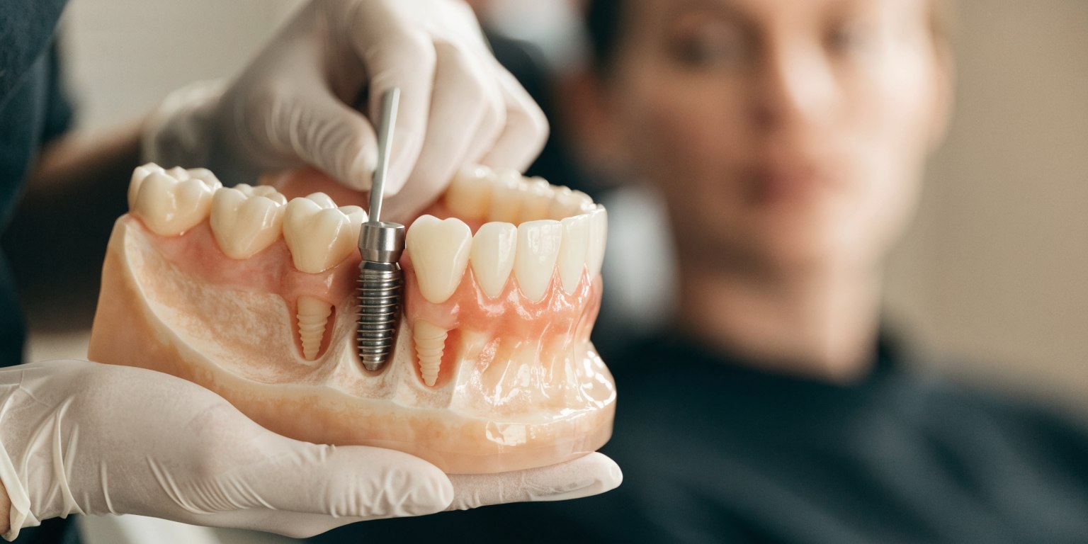Dentist explaining jawbone support for a dental implant using a realistic anatomical model